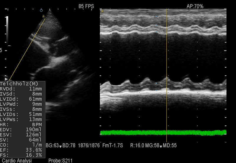 Medium kardiomiopatia ryc1 opt