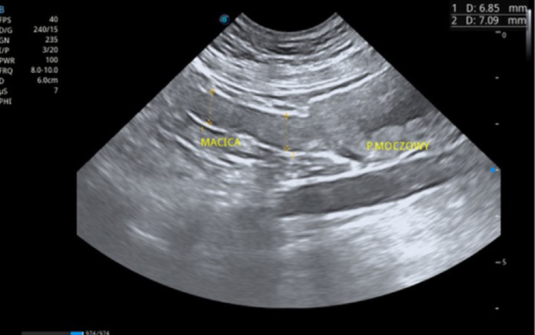 Medium mycoplasma ryc5 opt