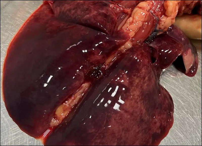 Medium frymus ryc2 opt