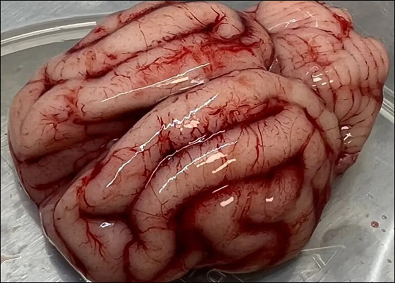 Medium frymus ryc3 opt