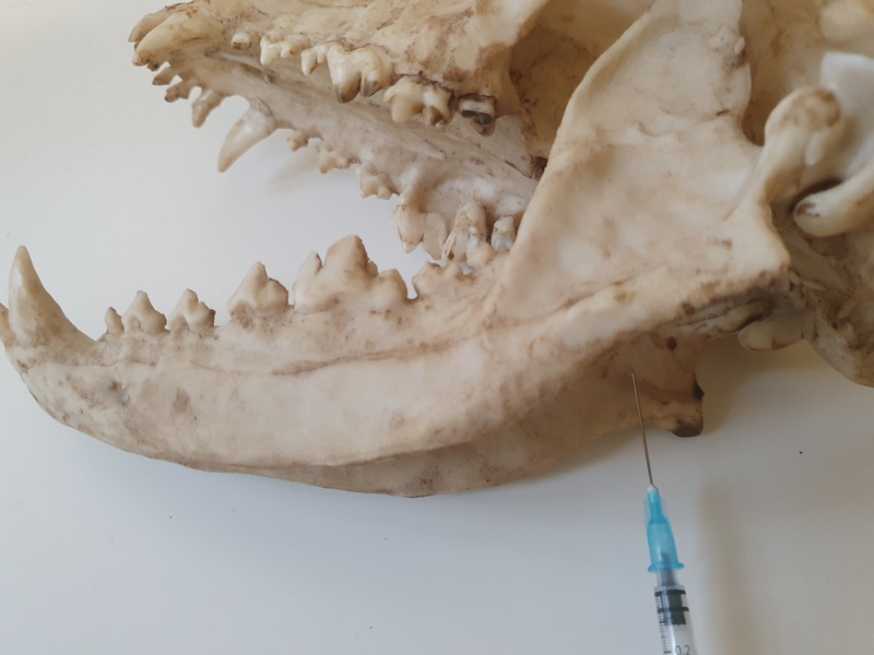 Medium znieczulenie ryc5 opt