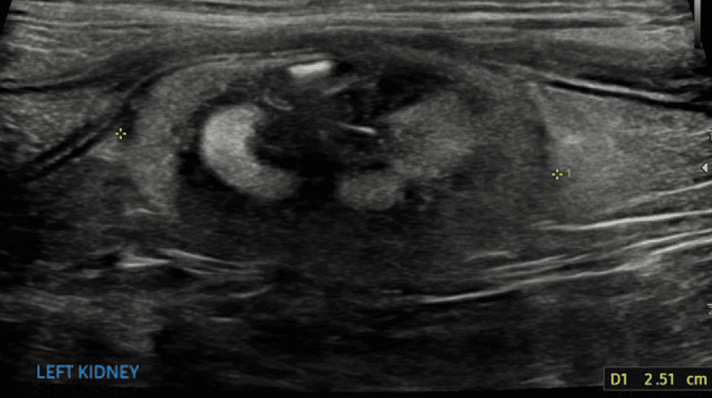 Medium huguet ryc10 opt