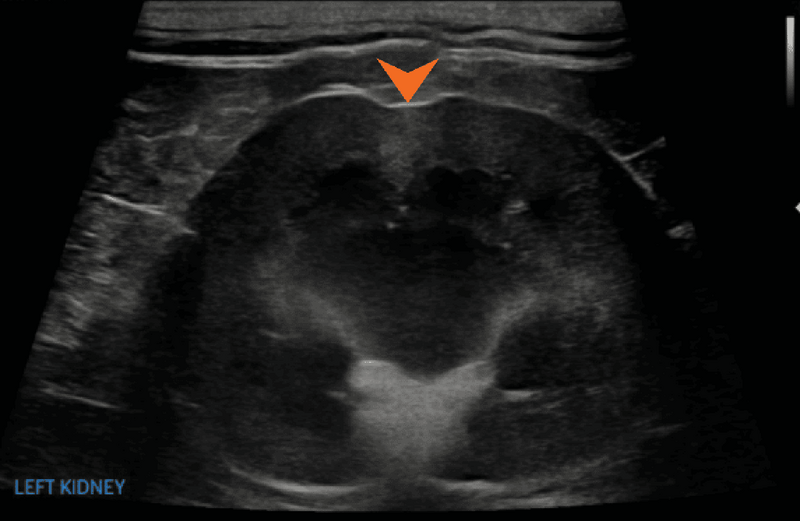 Medium huguet ryc13 opt