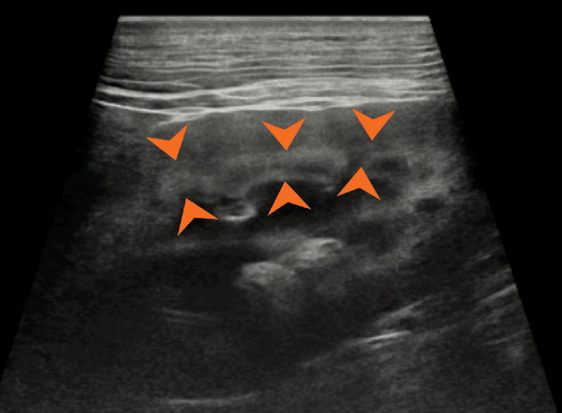 Medium huguet ryc2 opt