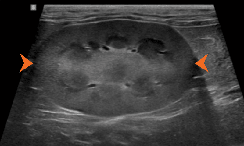 Medium huguet ryc4 opt