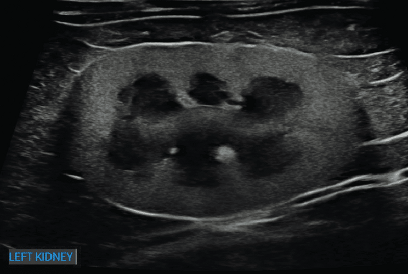 Medium huguet ryc3 opt