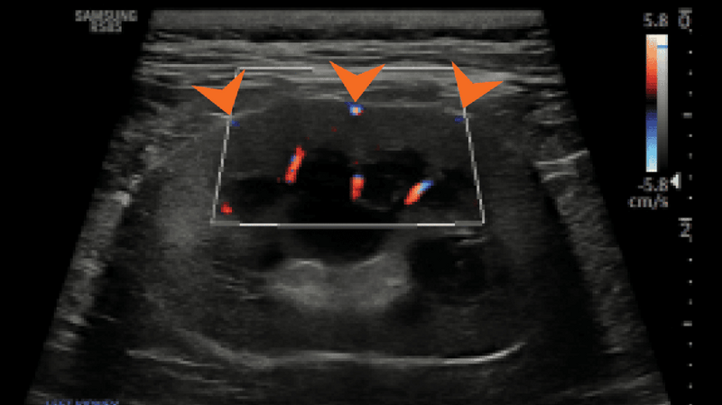 Medium huguet ryc5 opt