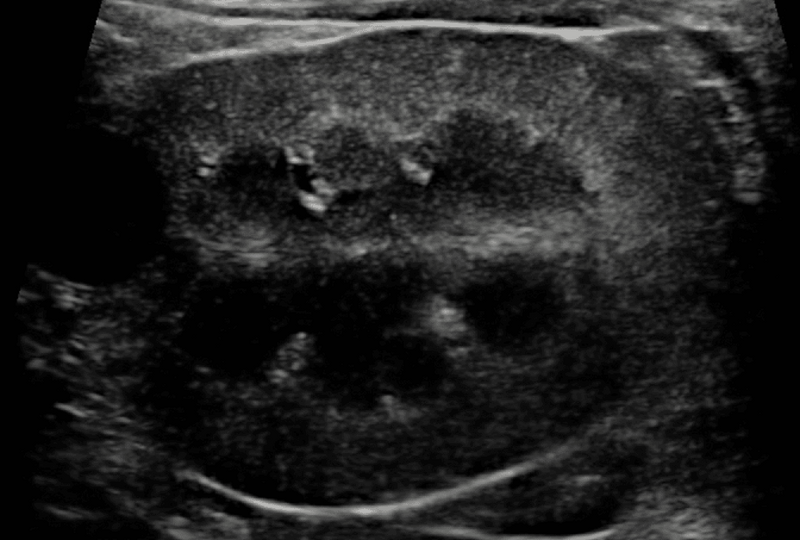 Medium huguet ryc6 opt