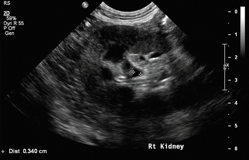 Medium huguet ryc8 opt