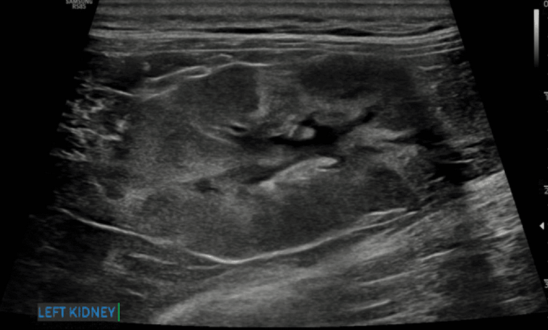 Medium huguet ryc9 opt