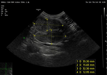 Medium wlokniejaca ryc1 opt