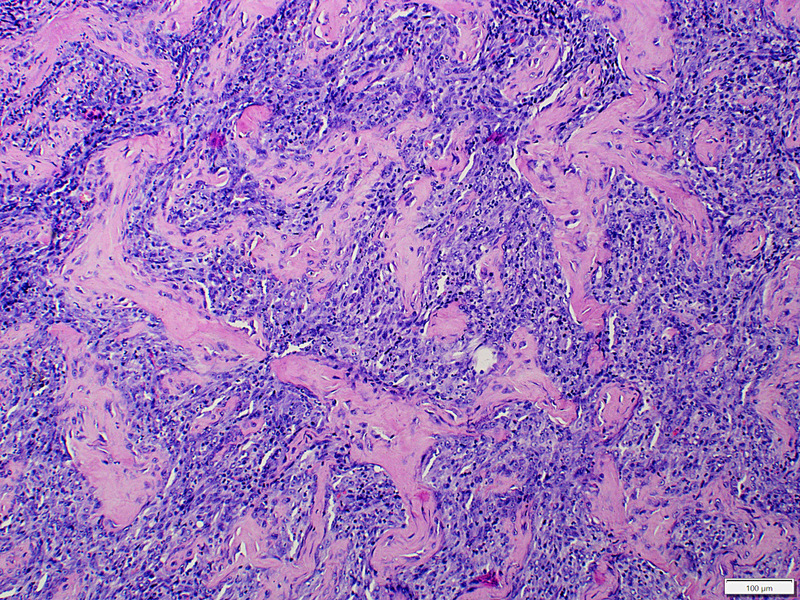 Medium wlokniejaca ryc3 opt