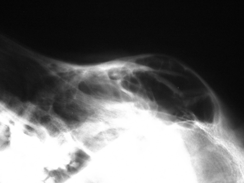 Medium obrazowanie ryc11 opt