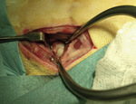 Small chirurgia ryc13 opt