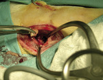 Small chirurgia ryc14 opt