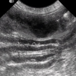 Small ultrasonografia ryc1 opt