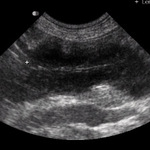 Small ultrasonografia ryc7 opt