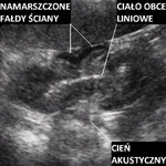 Small ultrasonografia ryc9 opt