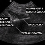 Small ultrasonografia ryc11 opt
