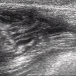 Small ultrasonografia ryc13 opt
