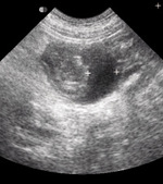 Small ultrasonografia ryc5 opt