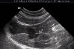 Small ultrasonografia ryc11 opt