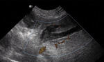 Small ultrasonografia ryc12 opt