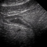 Small ultrasonografia ryc13 opt