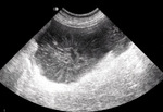 Small ultrasonografia ryc14 opt