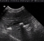 Small ultrasonografia ryc15 opt