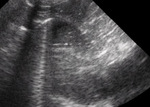 Small ultrasonografia ryc16 opt