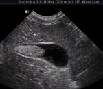 Small ultrasonografia ryc6 opt