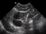 Small ultrasonografia ryc7 opt