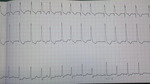 Small kardiomiopatia ryc3 opt